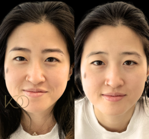 Before and after eyebrow tattoo transformation