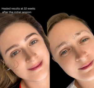 Healed nano brows 3 months after procedure